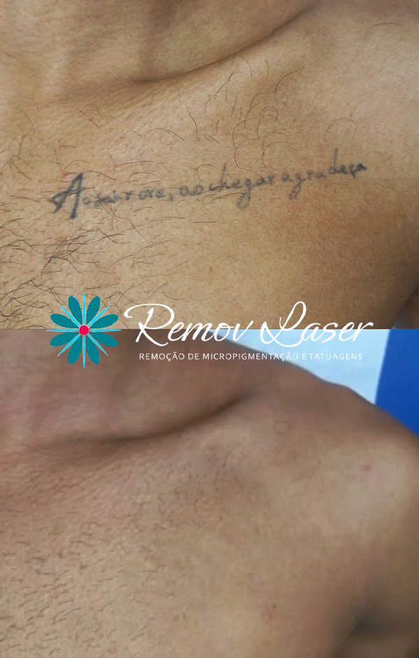 REM-TATUAGEM-01-1
