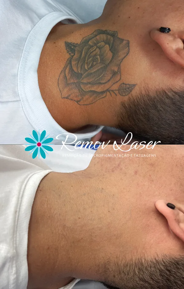 NOVA IMAGEM ANTES E DEPOIS 11-08 001