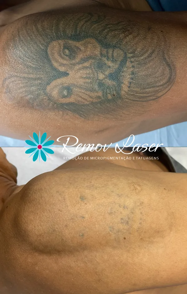 NOVA IMAGEM ANTES E DEPOIS 11-08 002