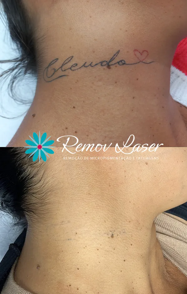 NOVA IMAGEM ANTES E DEPOIS 11-08 003